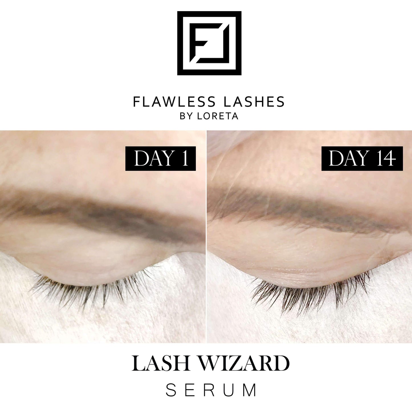 vorher nachher ergebnis unseres preisgekröntes luxury wimpernserum ohne hormone auch für brows geeignet und kann in der schwangerschaft sowie beim stillen verwendet werden.